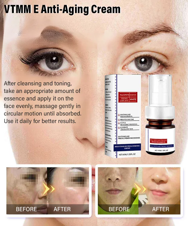 Freckle-Banishing Serum for Face